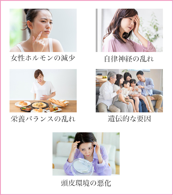 女性の薄毛に関係する主な原因